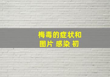 梅毒的症状和图片 感染 初